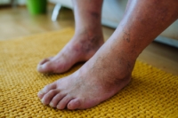 The Importance of Podiatric Examinations for Diabetic Patients