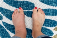 When to See a Doctor for Swollen Feet
