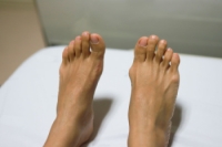 Non-Surgical Treatments for Bunions